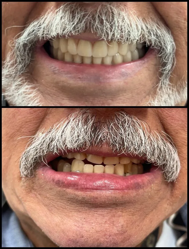 Antes e depois, caso real 1