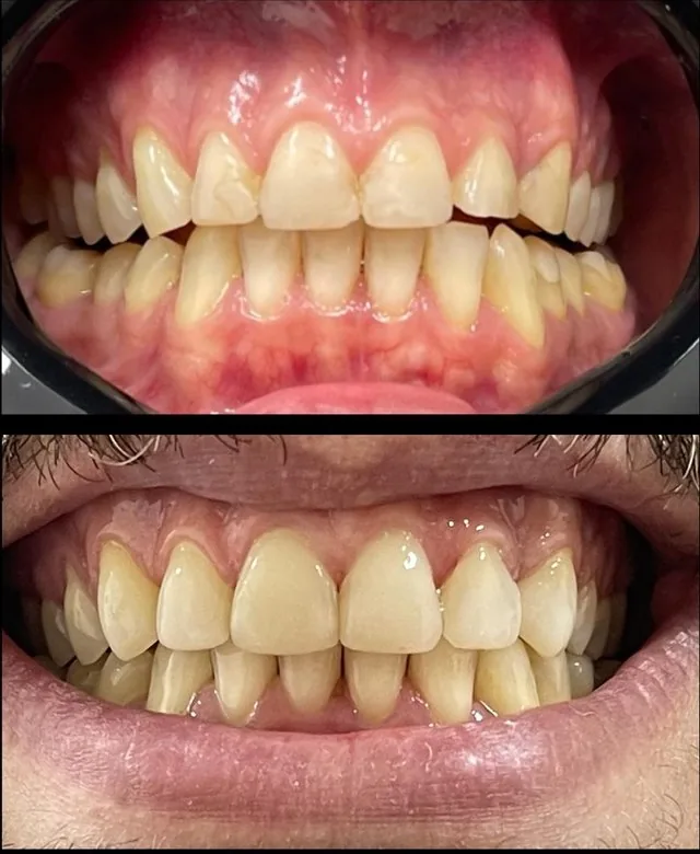 Antes e depois, caso real 1