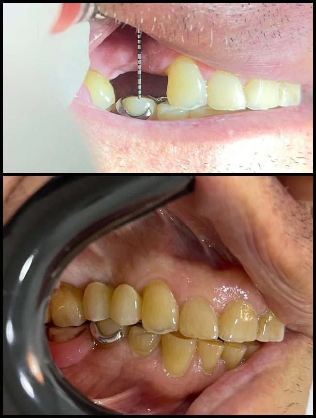 Antes e depois, caso real 2