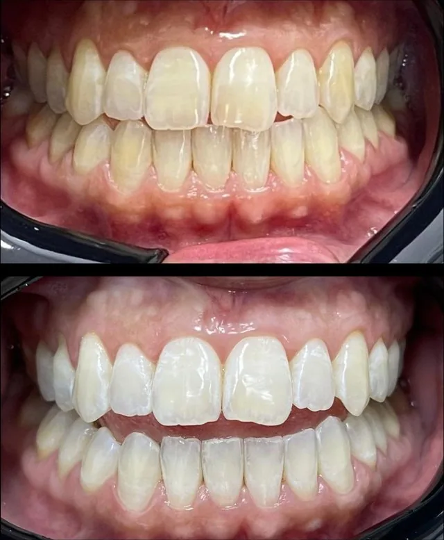 Antes e depois, caso real 2