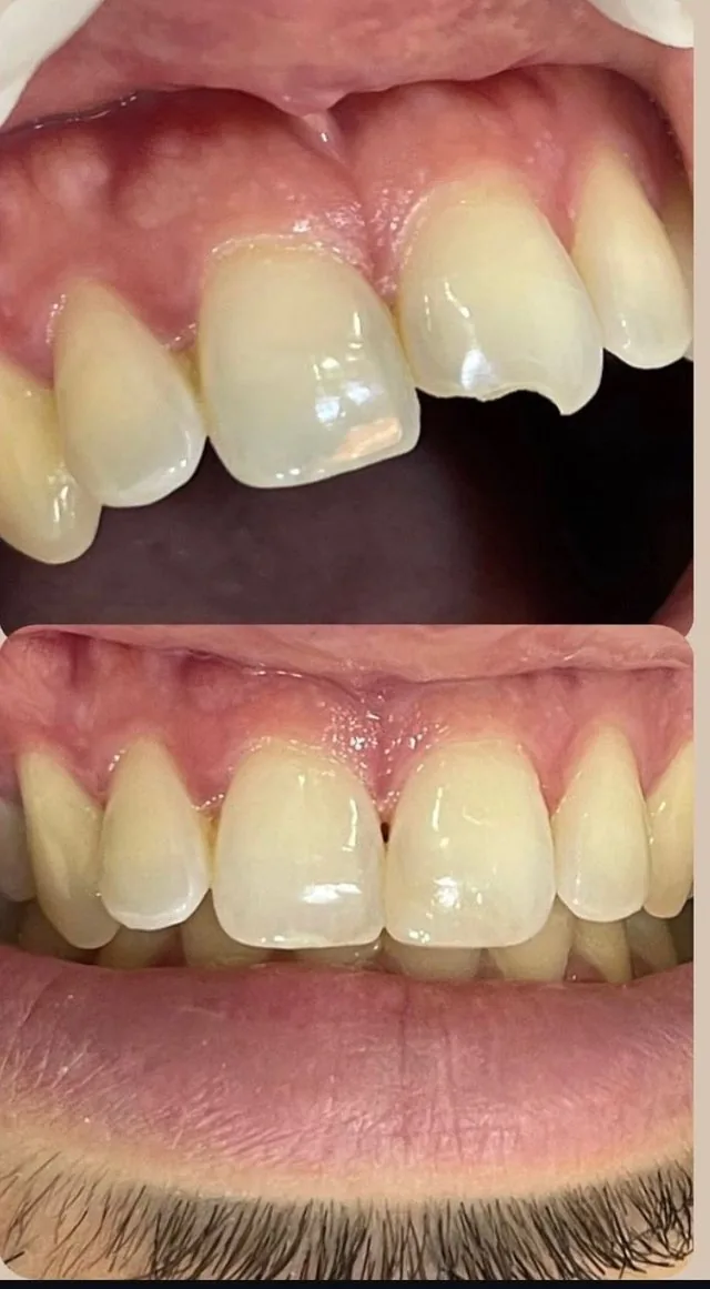 Antes e depois, caso real 5