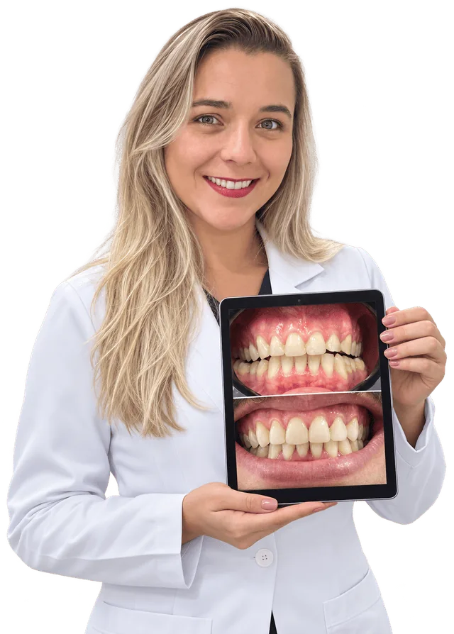 Dentista da Mazza Odontologia mostrando um caso de lentes de contato dentárias